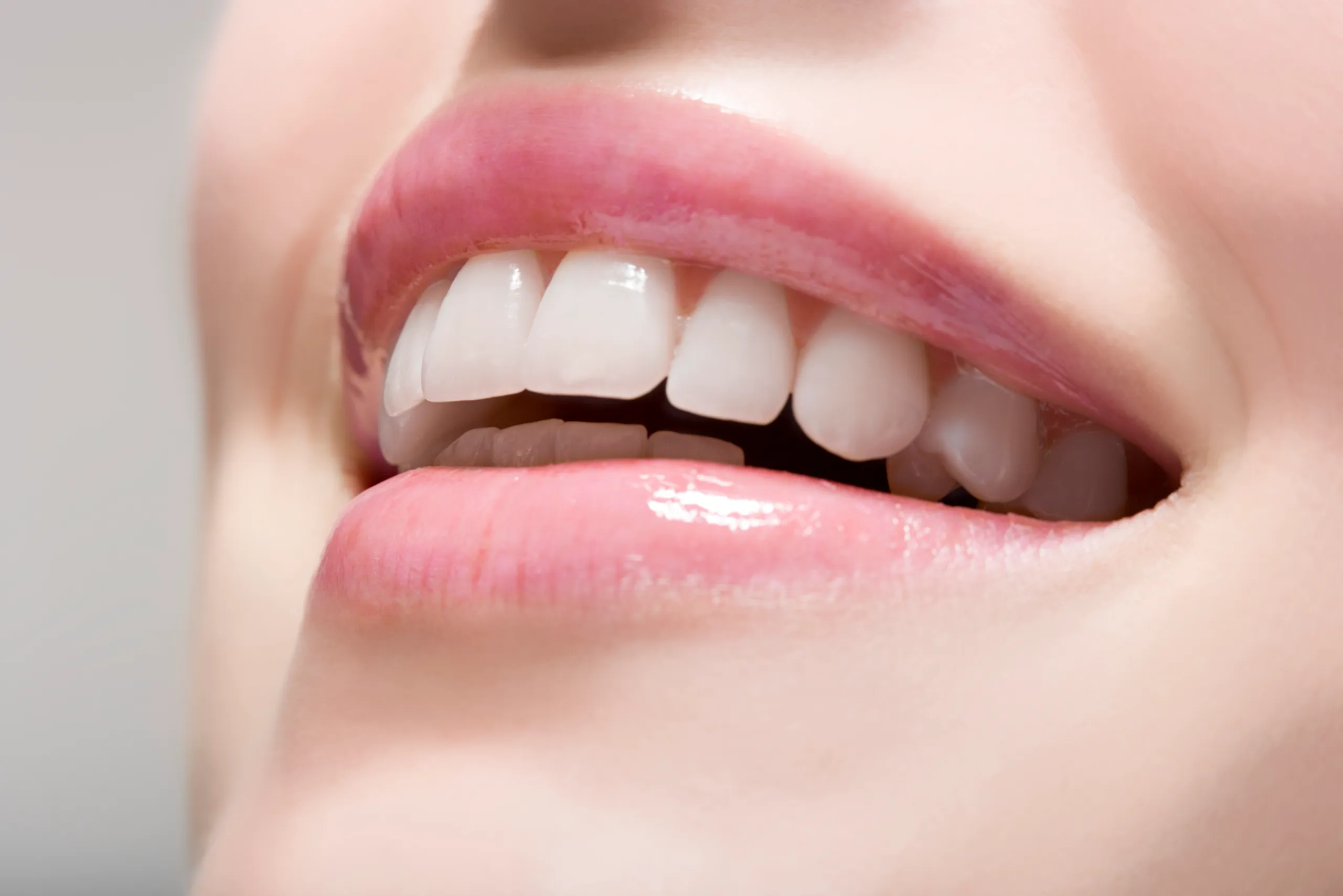 1 Hour Laser Teeth Whitening