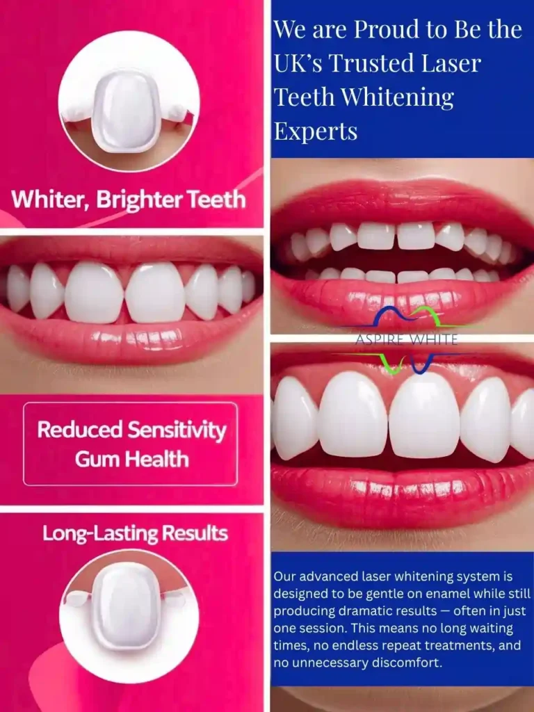 We are Proud to Be the UK’s Trusted Laser Teeth Whitening Experts Guildford