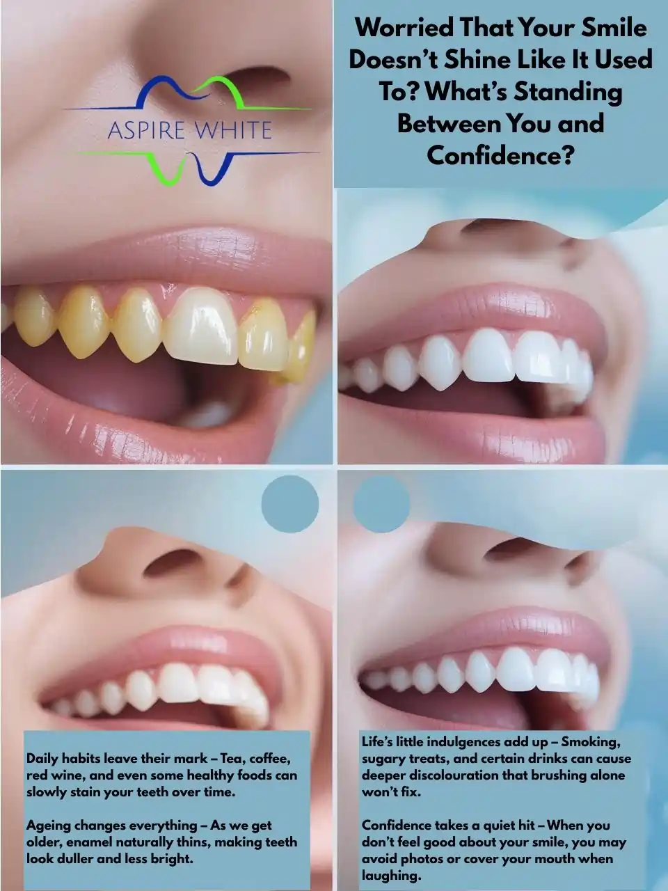 Worried That Your Smile Doesn’t Shine Like It Used To What’s Standing Between You and Confidence Guildford
